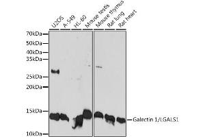 Western blot analysis of extracts of various cell lines, using Galectin 1/LG Rabbit mAb (ABIN7268197) at 1:1000 dilution.
