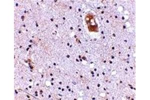 Immunohistochemistry (IHC) image for anti-Transmembrane Channel-Like 8 (TMC8) (Middle Region) antibody (ABIN1030928) (TMC8 anticorps  (Middle Region))
