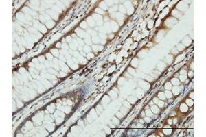 Image no. 2 for anti-Serine--tRNA Ligase, Cytoplasmic-Like (AA 1-515) antibody (ABIN598916) (Serine--tRNA Ligase, Cytoplasmic-Like (AA 1-515) anticorps)