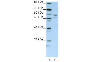 SARS antibody used at 1. (Seryl-tRNA Synthetase (SARS) (C-Term) anticorps)