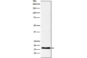 Western blot analysis of TFF2 expression in Human stomach lysate.