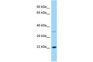 Host: Rabbit Target Name: KDELR2 Sample Type: RPMI-8226 Whole Cell lysates Antibody Dilution: 1. (KDELR2 anticorps  (Middle Region))