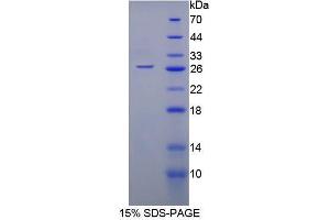 SDS-PAGE analysis of Mouse Monoamine Oxidase A Protein.