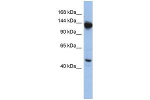 NRD1 antibody used at 1 ug/ml to detect target protein. (NRD1 anticorps)