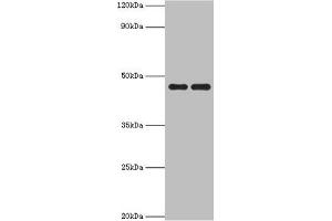 Western blot All lanes: Paired box protein Pax-6 antibody at 1 μg/mL Lane 1: Mouse stomach tissue Lane 2: Mouse eye tissue Secondary Goat polyclonal to rabbit IgG at 1/10000 dilution Predicted band size: 47, 49 kDa Observed band size: 47 kDa (PAX6 anticorps  (AA 1-300))