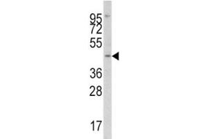 Western blot analysis of IRF8 antibody and Jurkat lysate.