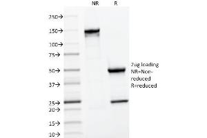 SDS-PAGE Analysis Purified CD22 Mouse Monoclonal Antibody (BLCAM/1796).