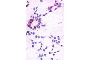 Immunocytochemistry (ICC) staining of HEK293 human embryonic kidney cells transfected (A) or untransfected (B) with GPR44. (Prostaglandin D2 Receptor 2 (PTGDR2) (3rd Extracellular Domain) anticorps)