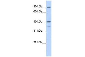 OAS1 antibody used at 0. (OAS1 anticorps  (Middle Region))