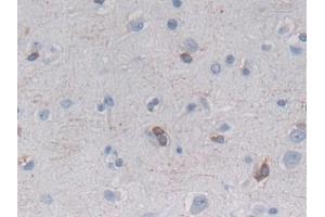 Detection of HSPb7 in Human Cerebrum Tissue using Polyclonal Antibody to Heat Shock Protein Beta 7 (HSPb7)