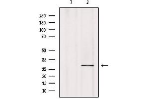 Western blot analysis of extracts from mouse brain, using CA7 Antibody.