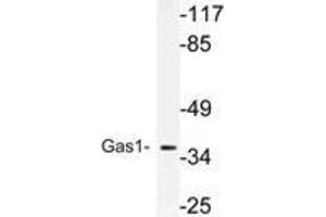 Western blot (WB) analysis of Gas1 antibody in extracts from MCF-7 cells.
