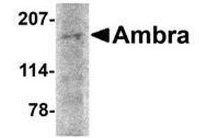 Western blot analysis of Ambra1 in rat brain tissue lysate with AP30048PU-N Ambra1 antibody at 2 μg/ml. (AMBRA1 anticorps  (N-Term))