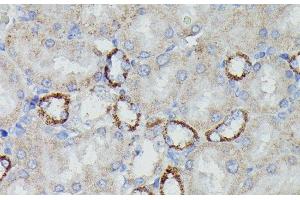 Immunohistochemistry of paraffin-embedded Rat kidney using NDUFAB1 Polyclonal Antibody at dilution of 1:100 (40x lens). (NDUFAB1 anticorps)
