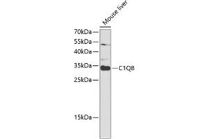 Western blot analysis of extracts of mouse liver, using C1QB antibody (ABIN6131395, ABIN6137754, ABIN6137756 and ABIN6220972) at 1:1000 dilution. (C1QB anticorps  (AA 104-253))