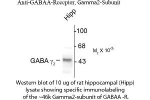 Western blot of GABAA Receptor γ2 Antibody Western Blot of Rabbit anti-GABAA Receptor γ2 Antibody. (GABRG2 anticorps  (Cytoplasmic Loop))