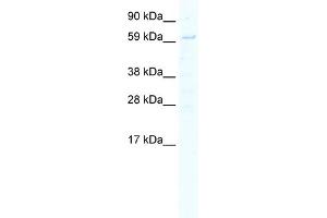 WB Suggested Anti-STAT1 Antibody Titration:  5. (STAT1 anticorps  (N-Term))