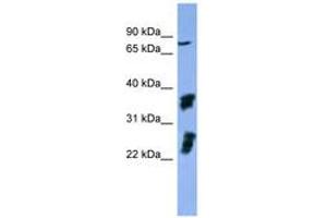 Image no. 1 for anti-Fibroblast Growth Factor Receptor 2 (FGFR2) (AA 508-557) antibody (ABIN6746746) (FGFR2 anticorps  (AA 508-557))