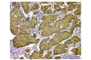 IHC analysis of STUB1 using anti STUB1 antibody (ABIN6719414).