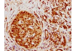 IHC image of ABIN7127548 diluted at 1:130.