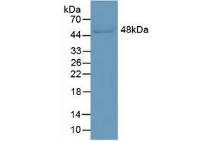 Detection of LRG1 in Human Serum using Monoclonal Antibody to Leucine Rich Alpha-2-Glycoprotein 1 (LRG1)