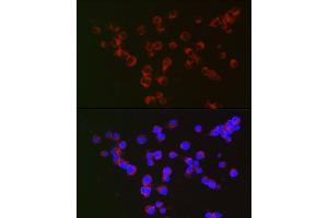 Immunofluorescence analysis of Neuro-2a cells using α-Synuclein Rabbit mAb (ABIN7270695) at dilution of 1:100 (40x lens). (SNCA anticorps  (AA 59-140))