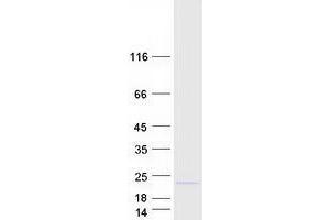 Validation with Western Blot (TSEN15 Protein (Transcript Variant 1) (Myc-DYKDDDDK Tag))