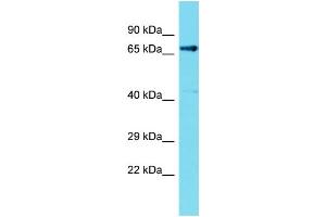 Host: Rabbit  Target Name: Fem1c  Sample Tissue: Rat Kidney lysates  Antibody Dilution: 1. (FEM1C anticorps  (C-Term))