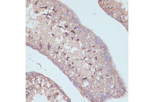 Immunohistochemistry of paraffin-embedded mouse testis using D antibody (ABIN7265495) at dilution of 1:100 (40x lens). (ARL4D anticorps  (AA 92-201))