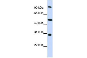 EML1 antibody used at 1 ug/ml to detect target protein. (EML1 anticorps  (C-Term))