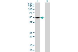 Western Blot analysis of C21orf2 expression in transfected 293T cell line by C21orf2 MaxPab polyclonal antibody. (C21orf2 anticorps  (AA 1-375))