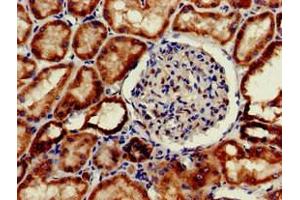 Immunohistochemistry of paraffin-embedded human kidney tissue using ABIN7156331 at dilution of 1:100 (Insulin Receptor anticorps  (AA 1023-1298))