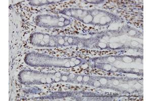 Immunoperoxidase of monoclonal antibody to MKNK1 on formalin-fixed paraffin-embedded human small Intestine.