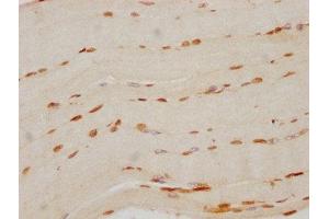 IHC image of ABIN7127502 diluted at 1:70 and staining in paraffin-embedded human skeletal muscle tissue performed on a Leica BondTM system. (Recombinant FTO anticorps)