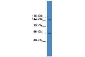 WB Suggested Anti-DHX57 Antibody Titration: 0. (DHX57 anticorps  (C-Term))