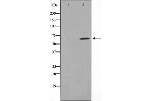 Western blot analysis on NIH-3T3 cell lysate using CCDC99 Antibody,The lane on the left is treated with the antigen-specific peptide. (CCDC99 anticorps  (C-Term))