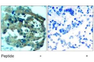 Image no. 1 for anti-Neurofibromin 2 (NF2) (AA 516-520) antibody (ABIN197520) (Merlin anticorps  (AA 516-520))