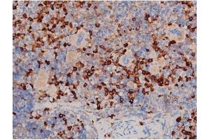 ABIN6267464 at 1/200 staining Mouse spleen tissue sections by IHC-P.