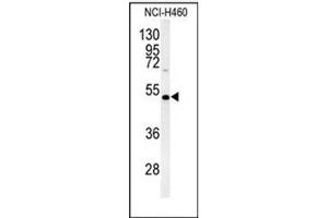 Western blot analysis of DGAT2 Antibody (N-term) in NCI-H460 cell line lysates (35ug/lane). (DGAT2 anticorps  (N-Term))