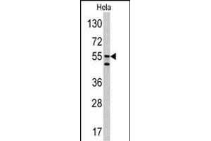 Western blot analysis of CA9 antibody (Center) (ABIN390041 and ABIN2840124) in Hela cell line lysates (35 μg/lane). (CA9 anticorps  (AA 113-143))
