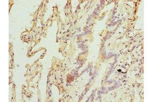Immunohistochemistry of paraffin-embedded human lung tissue using ABIN7151467 at dilution of 1:100