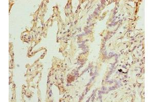 Immunohistochemistry of paraffin-embedded human lung tissue using ABIN7151467 at dilution of 1:100 (TPRKB anticorps  (AA 1-175))