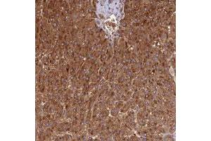 Immunohistochemical staining of human liver with DUS2L polyclonal antibody  shows strong cytoplasmic positivity in hepatocytes. (DUSL2 anticorps)