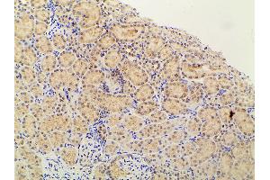 ABIN6267452 at 1/100 staining rat kidney tissue sections by IHC-P. (PIK3R1 anticorps  (pTyr607))