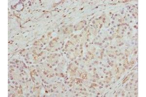 Immunohistochemistry of paraffin-embedded human pancreatic tissue using ABIN7154163 at dilution of 1:100 (GPD2 anticorps  (AA 25-325))