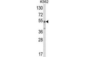 Western Blotting (WB) image for anti-WD Repeat, Sterile alpha Motif and U-Box Domain Containing 1 (WDSUB1) antibody (ABIN3003923)