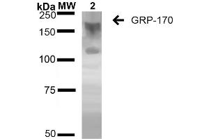 Western Blot analysis of Human Embryonic kidney epithelial cell line (HEK293) lysates showing detection of ~170 kDa GRP170 protein using Mouse Anti-GRP170 Monoclonal Antibody, Clone 6E3-2C2 (ABIN2868629).