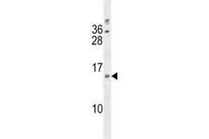 DUSP13 antibody western blot analysis in A2058 lysate (DUSP13 anticorps  (AA 147-173))