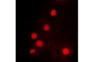 Immunofluorescent analysis of HOXC6 staining in K562 cells. (Homeobox C6 anticorps  (C-Term))