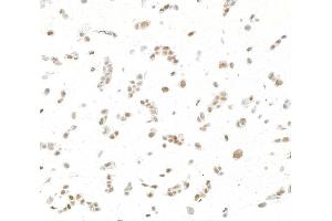 Immunocytochemistry (ICC) image for anti-Jun Dimerization Protein 2 (JDP2) (AA 50-100) antibody (ABIN7795636) (Recombinant JDP2 anticorps  (AA 50-100))